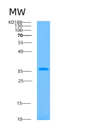 Recombinant Human B3GAT3 Protein