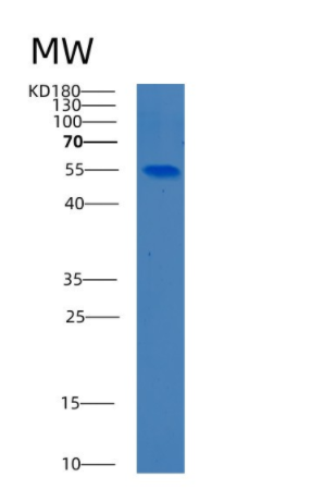 Recombinant Human BECN1 Protein