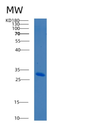 Recombinant Human BCL10 Protein