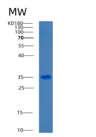 Recombinant Human BDH1 Protein