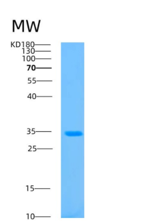 Recombinant Human AZGP1 Protein