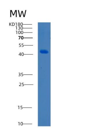 Recombinant Human BCAT2 Protein