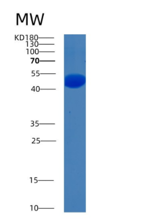 Recombinant Human BHMT (βine-homocysteine methyltransferase) Human Protein