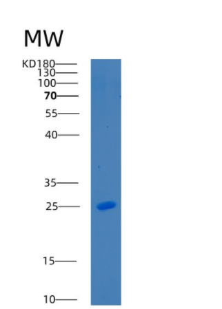 Recombinant Mouse C-reactive protein Protein