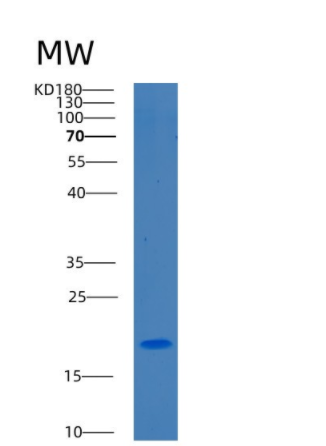 Recombinant Human C1D Protein