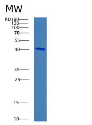 Recombinant Human BRAF Protein