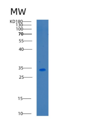 Recombinant Human CA14 Protein