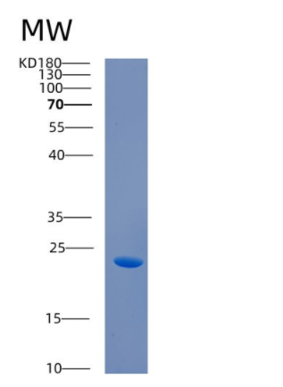 Recombinant Human CABP7 Protein