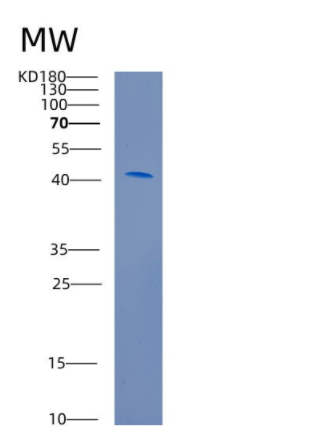 Recombinant Human CADM1 Protein