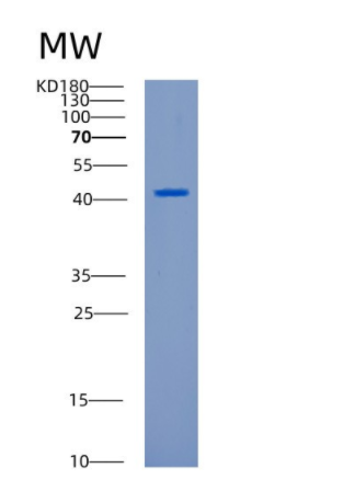 Recombinant Human CANT1 Protein