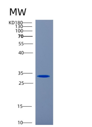 Recombinant Human Carbonic anhydrase 1 Protein