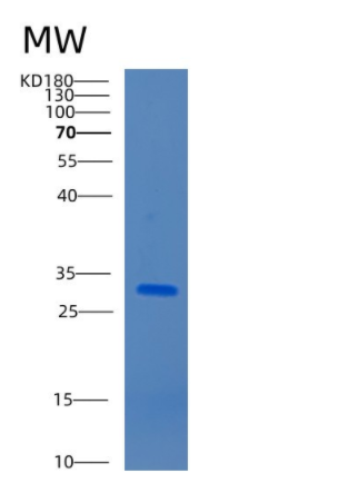 Recombinant Human Carbonic anhydrase 2 Protein