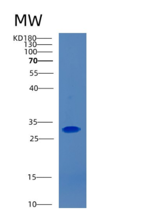 Recombinant E.coli Carbonic anhydrase Protein