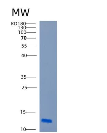 Recombinant Human CARD18 Protein