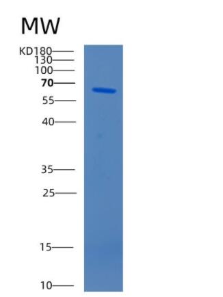 Recombinant Human CAT Protein