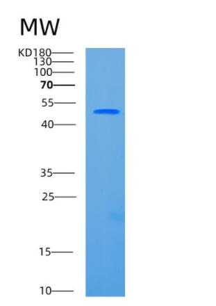 Recombinant Human CCBL1 Protein