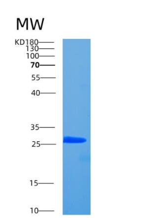 Recombinant Human CCDC25 Protein