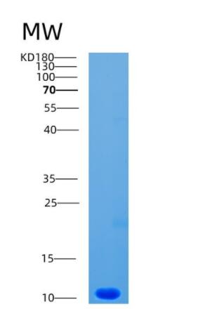 Recombinant Human CCL1 Protein