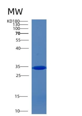 Recombinant Human CCM2 Protein