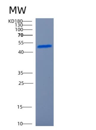 Recombinant Human CCNB2 Protein