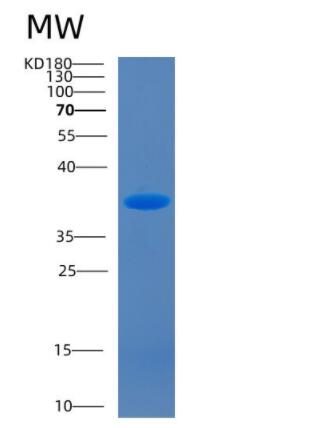 Recombinant Mouse Cd14 Protein