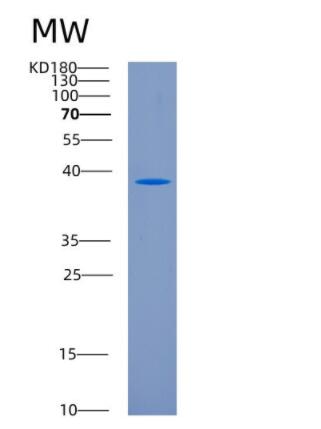 Recombinant Human CD207 Protein