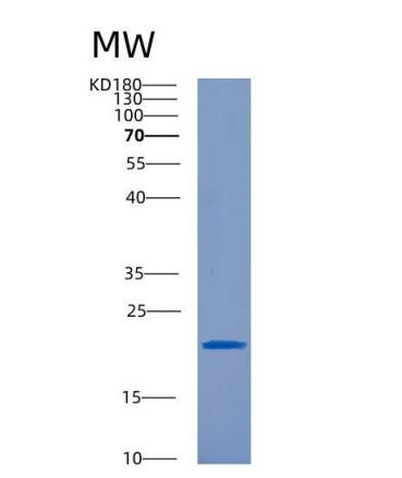 Recombinant Tumor Necrosis Factor Receptor Superfamily, Member 7 (TNFRSF7)