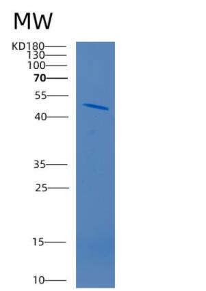 Recombinant Human CD320 Protein