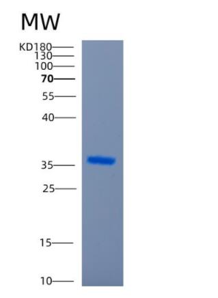 Recombinant Human CCNG1 Protein