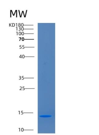 Recombinant Human CD164L2 Protein