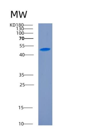 Recombinant Human CD27 Protein