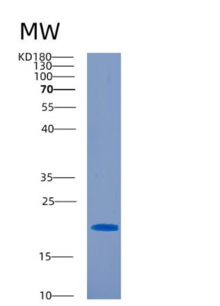 Recombinant Human CD300C Protein