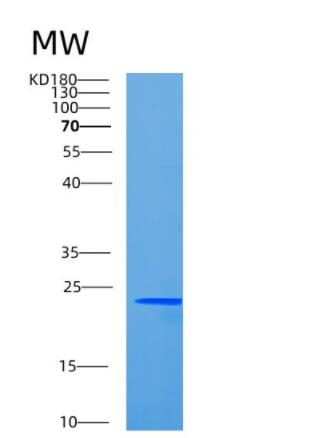 Recombinant Human CCDC90B Protein