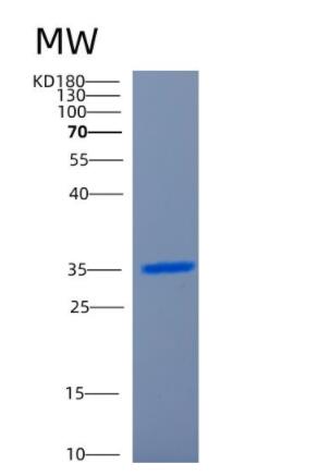 Recombinant Human CCND2 Protein