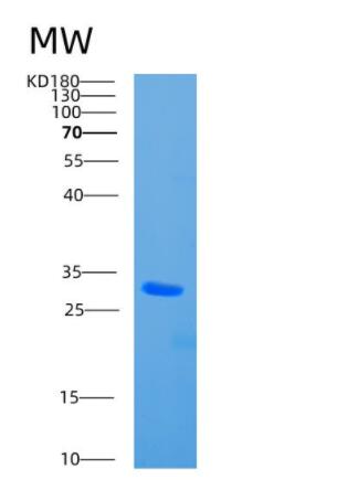 Recombinant Human CBR4 Protein