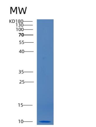 Recombinant Human CCL3 Protein