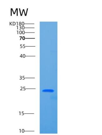 Recombinant Human CBX5 Protein