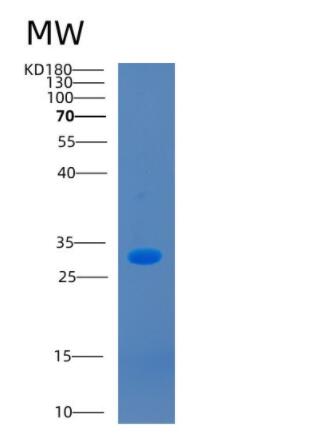 Recombinant Human CCS Protein