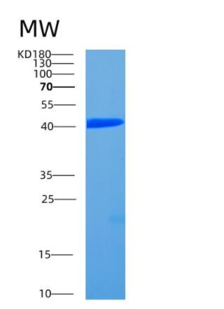 Recombinant Human CCDC104 Protein