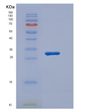 Recombinant Cluster Of Differentiation 1e (CD1e)