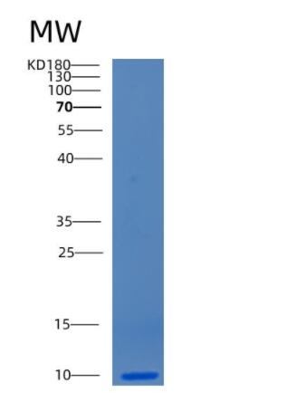 Recombinant Human CCL15 Protein