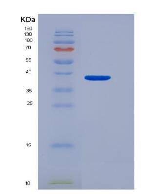 Recombinant CD300 Antigen Like Family Member C (CD300c)