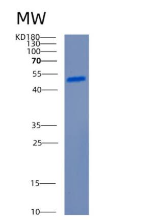 Recombinant Human CCNB1 Protein