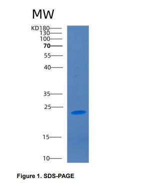 Recombinant Cluster Of Differentiation 2 (CD2)