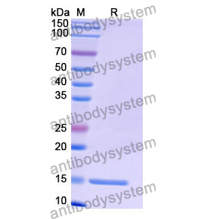 Anti-Human OLR1/LOX1 Nanobody (SAA1291)