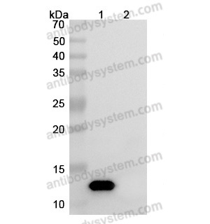 中和抗体-Human IL8/CXCL8 (Iv0023) VHC79101