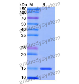 Anti-Human CD202b/TEK/TIE-2 Nanobody (SAA1254)