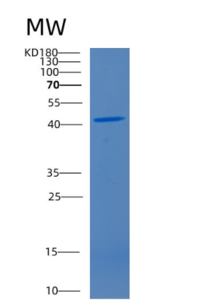Recombinant Human CD4 Protein