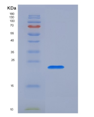 Recombinant T-Cell Surface Glycoprotein CD3 Epsilon (CD3e)