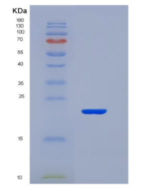 Recombinant Tumor Necrosis Factor Receptor Superfamily, Member 5 (CD40)